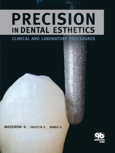 Precision in dental esthetics