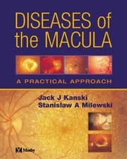 Diseases of the macula