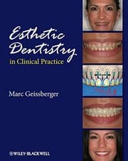 Esthetic dentistry in clinical practice