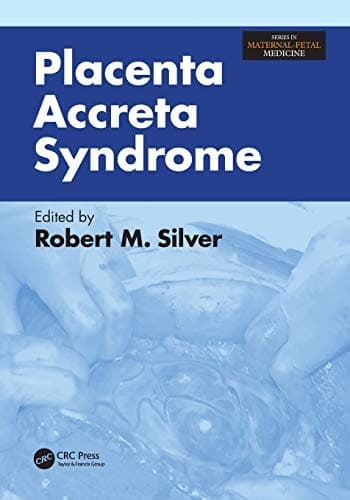 Placenta Accreta Syndrome