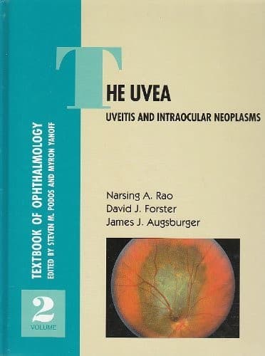 Uvea
