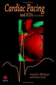 Cardiac pacing and ICDs