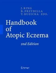 Handbook of atopic eczema
