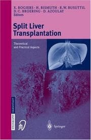 Split liver transplantation