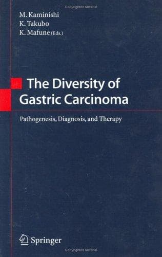 The diversity of gastric carcinoma