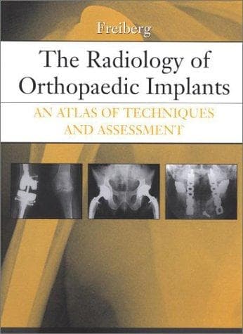 The Radiology of Orthopaedic Implants