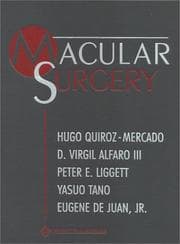 Macular Surgery