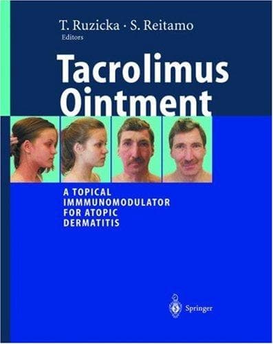 Tacrolimus ointment