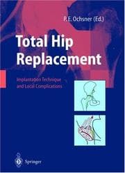 Total hip replacement