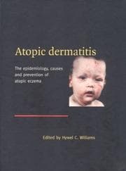 Atopic Dermatitis