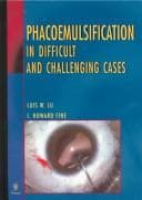 Phacoemulsification in difficult and challenging cases
