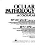 Ocular pathology