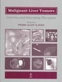 Malignant liver tumors