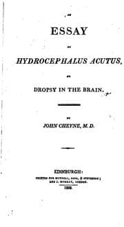 An essay on hydrocephalus acutus, or dropsy in the brain