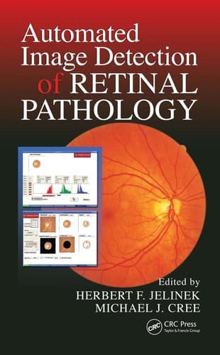 Automated image detection of retinal pathology