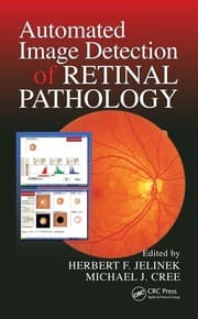 Automated image detection of retinal pathology