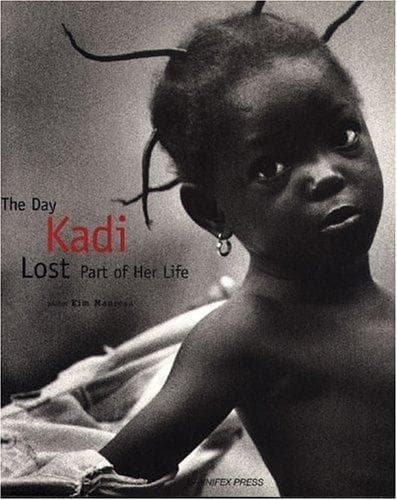 The day Kadi lost part of her life