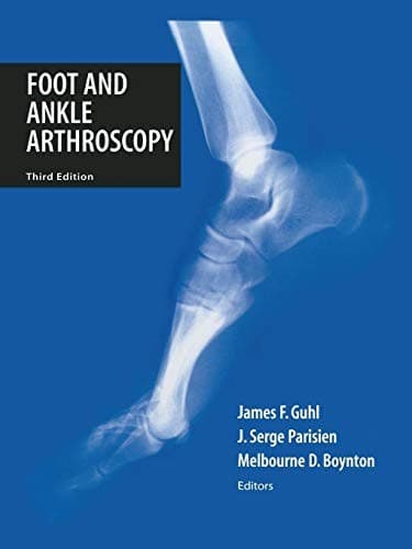 Foot and ankle arthroscopy